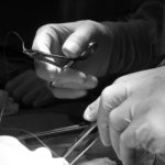 Crossing the Line - 1 suturing