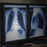 A Good Day - 1 ZebraRadiology_cropped